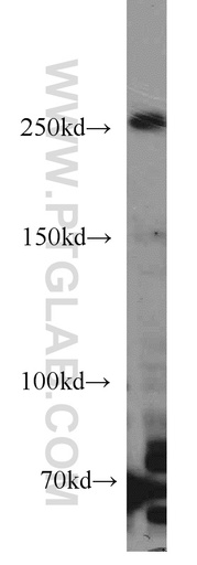 [17084-1-AP-150UL] RAI1 Polyclonal antibody