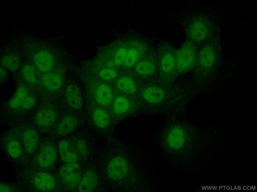 [17086-1-AP-20UL] PDPK1 Polyclonal antibody
