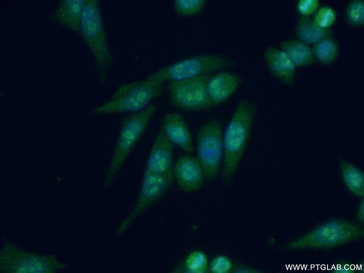 [17087-1-AP-20UL] DDX27 Polyclonal antibody
