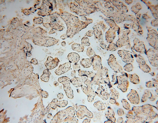 [17088-1-AP-150UL] TUBGCP4 Polyclonal antibody