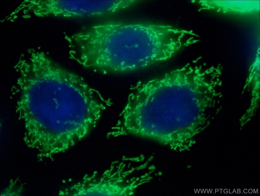 [17089-1-AP-150UL] OAT Polyclonal antibody