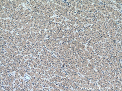 [17092-1-AP-150UL] METTL7A Polyclonal antibody