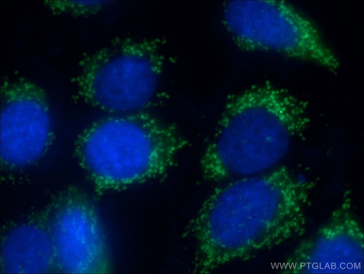[17097-1-AP-150UL] LARS2 Polyclonal antibody