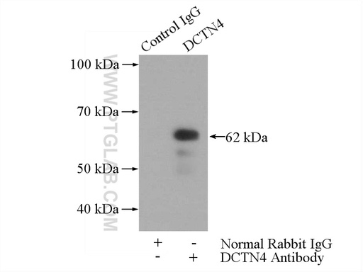 [17098-1-AP-150UL] DCTN4 Polyclonal antibody