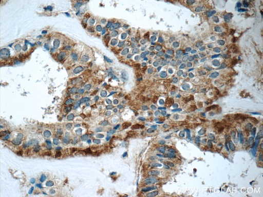 [17105-1-AP-20UL] GNPDA2 Polyclonal antibody