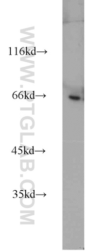[17106-1-AP-20UL] PPWD1 Polyclonal antibody