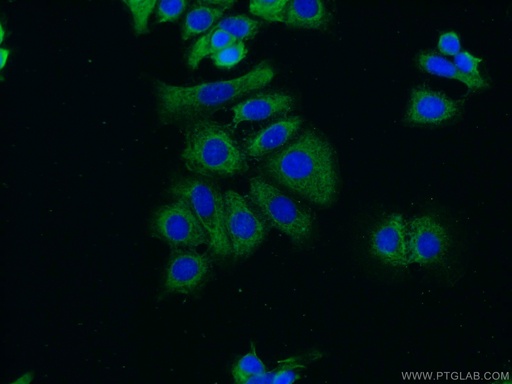 [17113-1-AP-150UL] RUNDC3B Polyclonal antibody