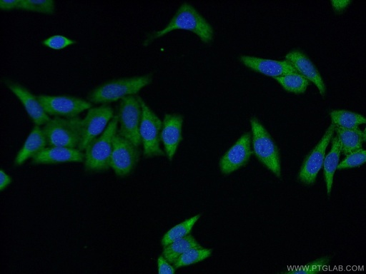 [17114-1-AP-20UL] UPF3A Polyclonal antibody