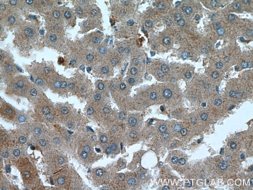 [17116-1-AP-150UL] OMA1 Polyclonal antibody