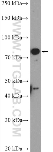 [17117-1-AP-150UL] KLHL11 Polyclonal antibody