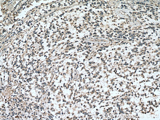 [17121-1-AP-150UL] RASGEF1A Polyclonal antibody