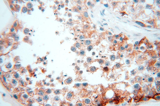 [17122-1-AP-20UL] OXCT2 Polyclonal antibody