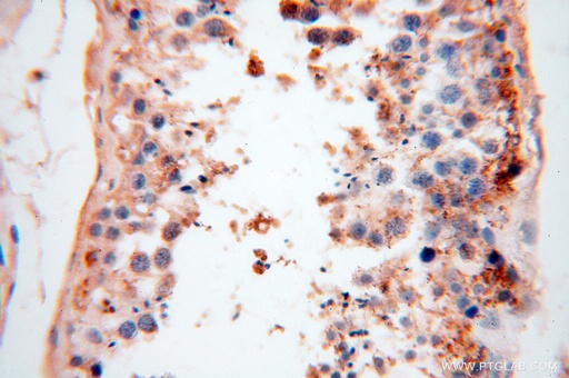 [17125-1-AP-150UL] CSNK1A1L Polyclonal antibody