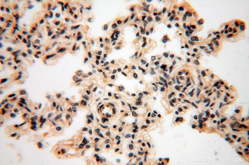 [17131-1-AP-150UL] GALNTL5 Polyclonal antibody