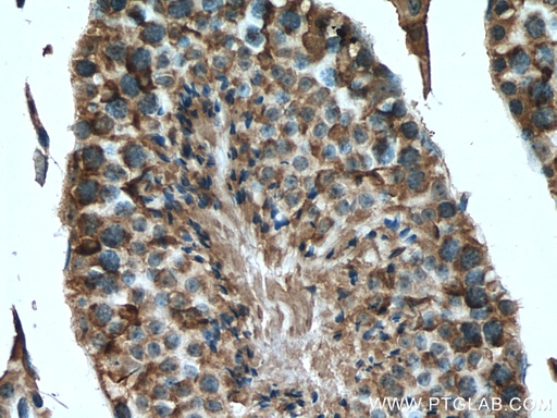 [17134-1-AP-150UL] PDHA2 Polyclonal antibody