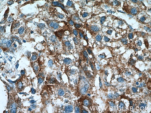 [17138-1-AP-150UL] ACSS1 Polyclonal antibody