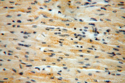 [17142-1-AP-150UL] B3GALNT2 Polyclonal antibody