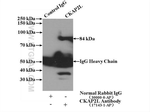 [17143-1-AP-150UL] CKAP2L Polyclonal antibody