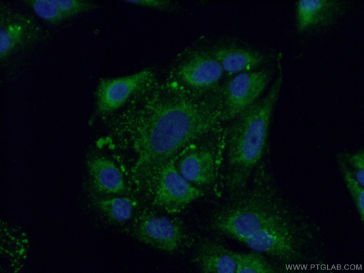 [17147-1-AP-20UL] FAM160B2 Polyclonal antibody