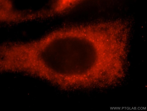 [17149-1-AP-150UL] PGS1 Polyclonal antibody