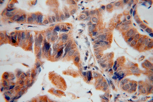 [17157-1-AP-20UL] FCRLB Polyclonal antibody