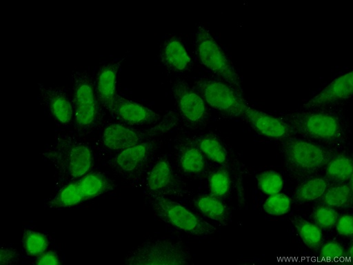 [17158-1-AP-150UL] TCEA3 Polyclonal antibody