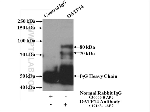 [17163-1-AP-150UL] OATP14 Polyclonal antibody