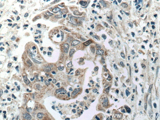 [17165-1-AP-20UL] ADH1B Polyclonal antibody
