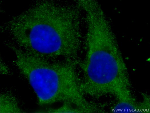 [17169-1-AP-150UL] LOH12CR1 Polyclonal antibody