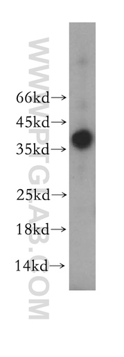 [17171-1-AP-20UL] PSCA Polyclonal antibody