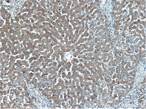[17172-1-AP-150UL] MT1X Polyclonal antibody