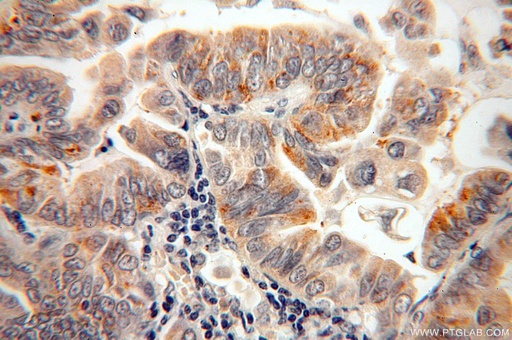 [17174-1-AP-150UL] CAPSL Polyclonal antibody