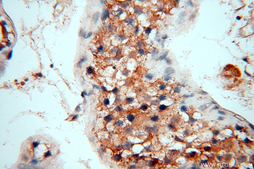 [17175-1-AP-150UL] FUT11 Polyclonal antibody