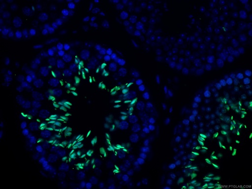 [17178-1-AP-20UL] TNP1 Polyclonal antibody
