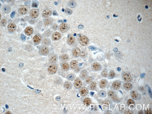 [17179-1-AP-20UL] RALYL Polyclonal antibody