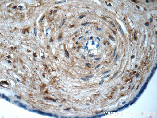 [17180-1-AP-150UL] LETM2 Polyclonal antibody