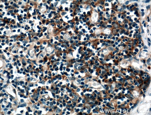 [17183-1-AP-150UL] AFAP1L2 Polyclonal antibody