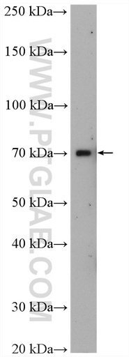 [17187-1-AP-150UL] ZFP64 Polyclonal antibody