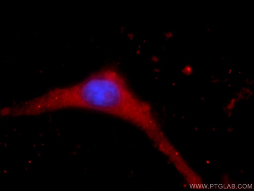 [17188-1-AP-150UL] KCNN3 Polyclonal antibody