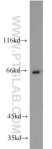 [17190-1-AP-150UL] CBFA2T3 Polyclonal antibody