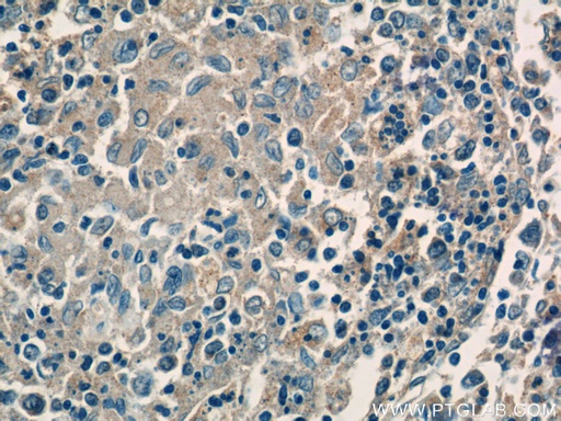 [17192-1-AP-20UL] CFP Polyclonal antibody