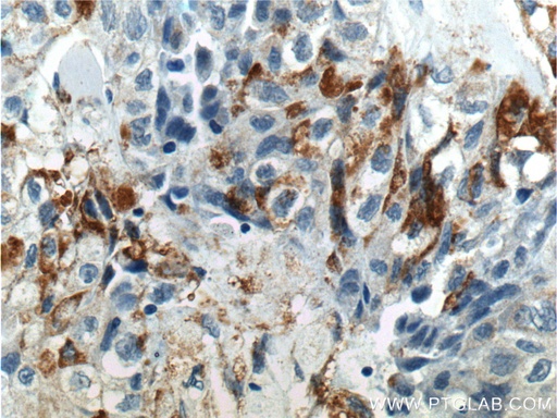 [17193-1-AP-150UL] RSPO3 Polyclonal antibody