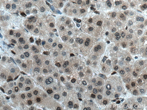 [17195-1-AP-20UL] MGMT Polyclonal antibody