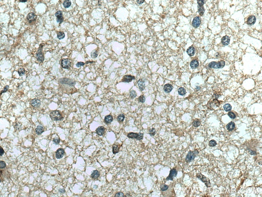 [17203-1-AP-150UL] RNASE11 Polyclonal antibody