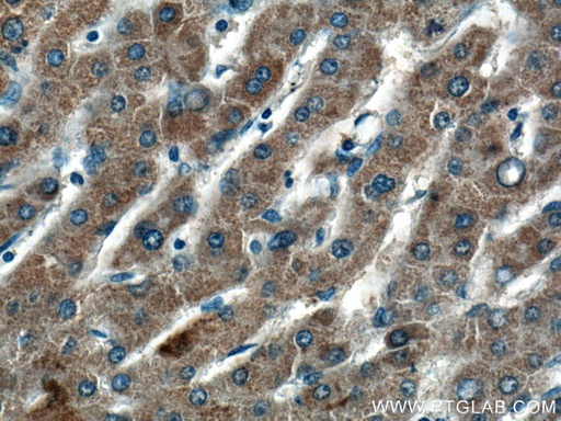 [17206-1-AP-20UL] HMGCLL1 Polyclonal antibody