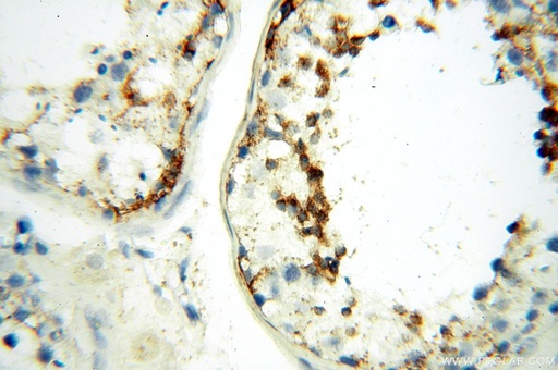 [17207-1-AP-150UL] LYZL1 Polyclonal antibody