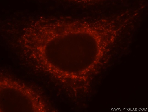 [17215-1-AP-20UL] NLRX1 Polyclonal antibody