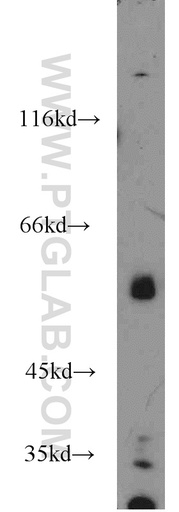 [17217-1-AP-150UL] OSBPL2 Polyclonal antibody