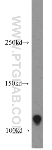 [17218-1-AP-150UL] Rb Polyclonal antibody