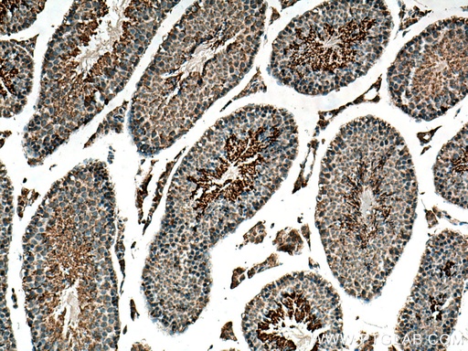 [17219-1-AP-20UL] GPD2 Polyclonal antibody
